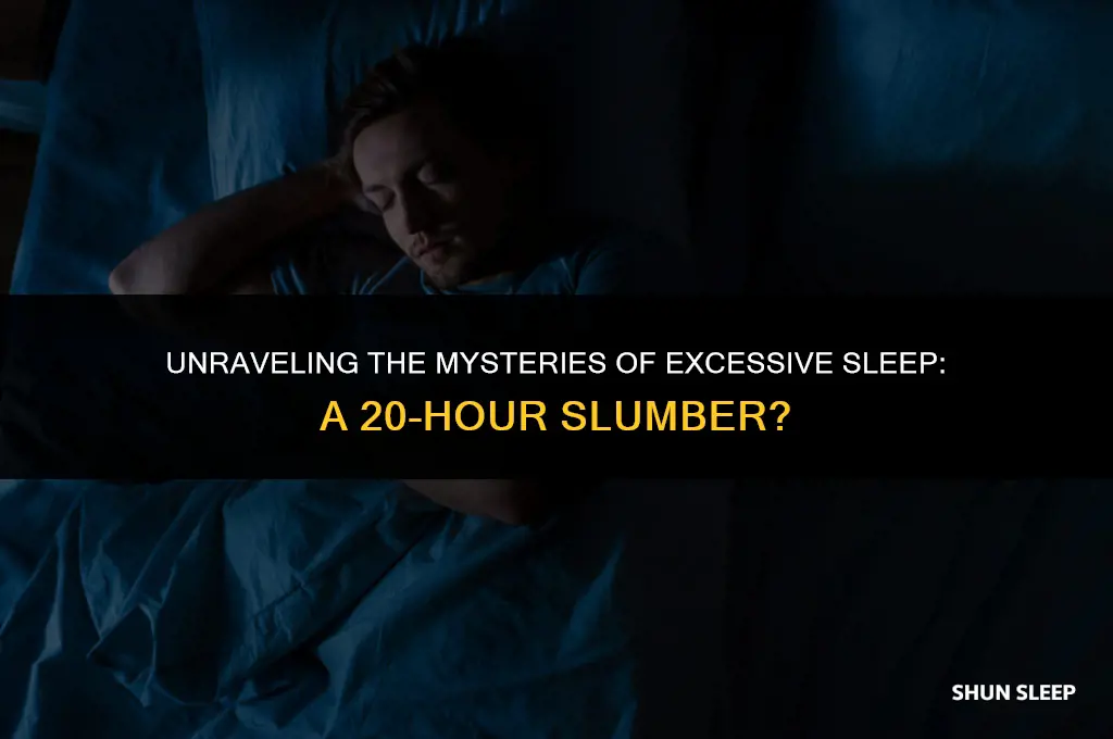 can you sleep 20 hours a day