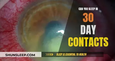 Sleeping in 30-Day Contacts: Is It Safe?