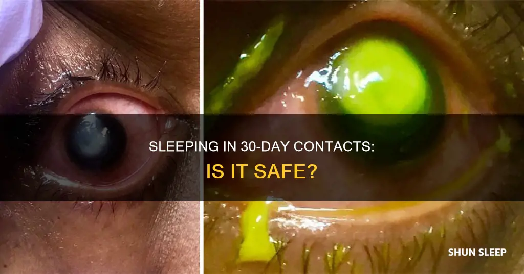 can you sleep in 30 day contacts