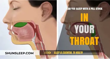 Pill stuck in throat: Sleep or stay awake?