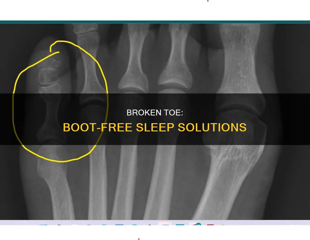can you sleep without boot with broken toe