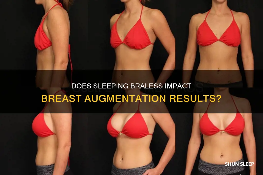 can you sleep without bra after breast augmentation
