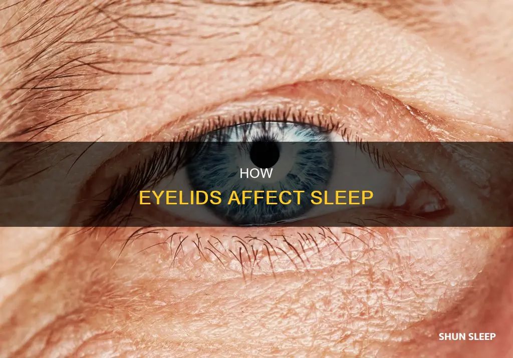 can you sleep without eyelids