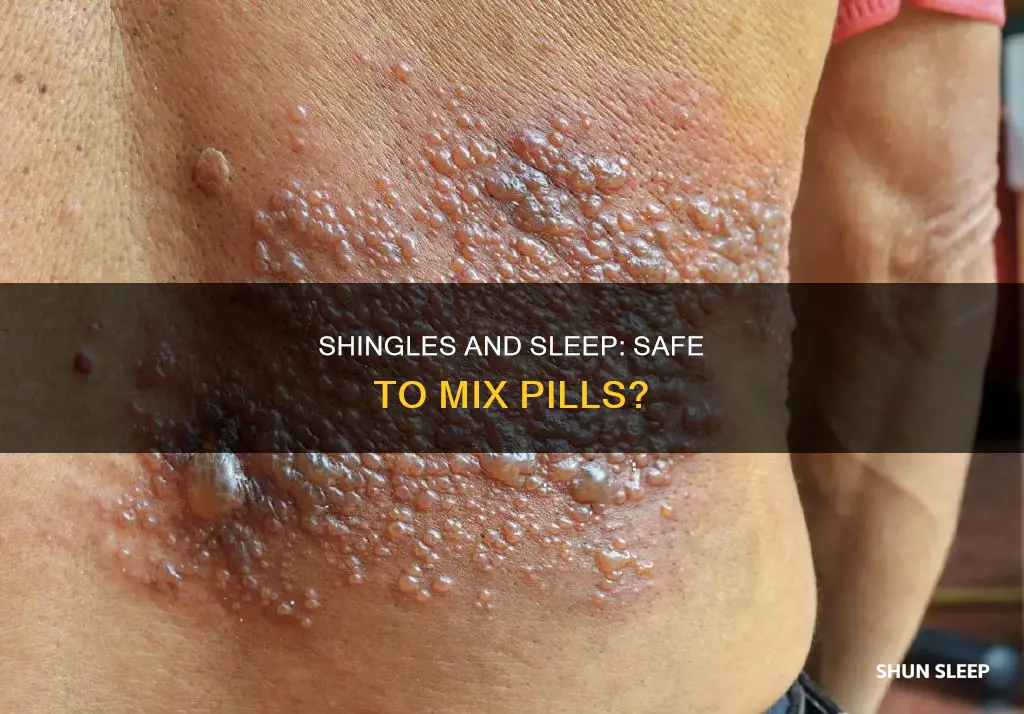 can you take sleeping pills when you have shingles