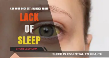 Lack of Sleep and Jaundice: Unraveling the Surprising Connection