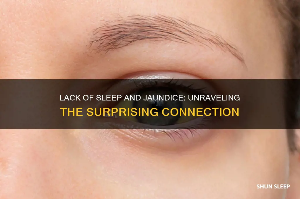 can your body get jaundice from lack of sleep