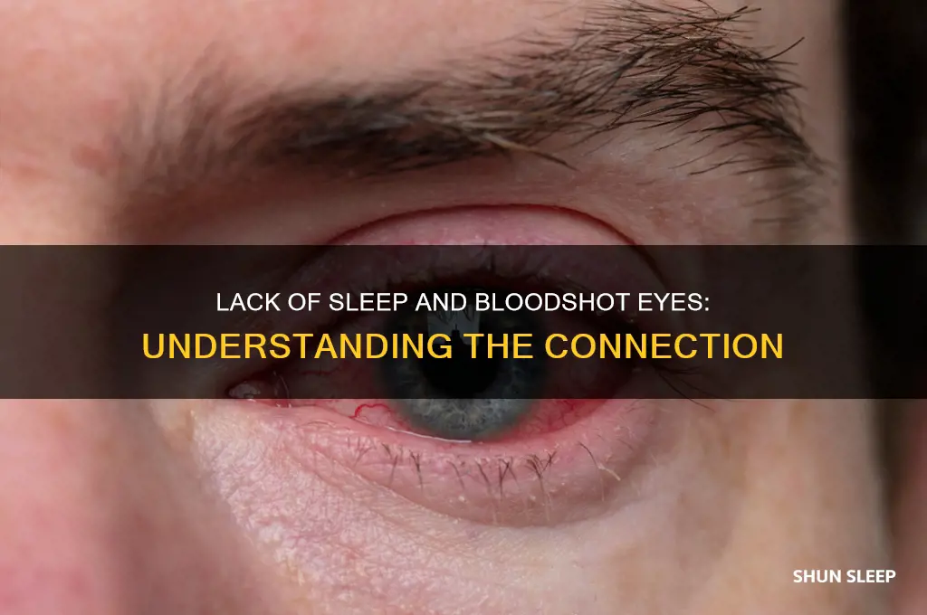 can your eyes get bloodshot from lack of sleep