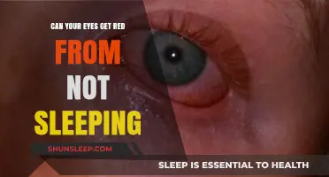 Lack of Sleep and Red Eyes: Understanding the Connection