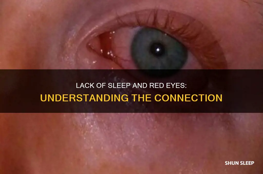can your eyes get red from not sleeping