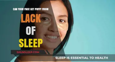 Sleep Deprivation and Facial Puffiness: Understanding the Surprising Connection