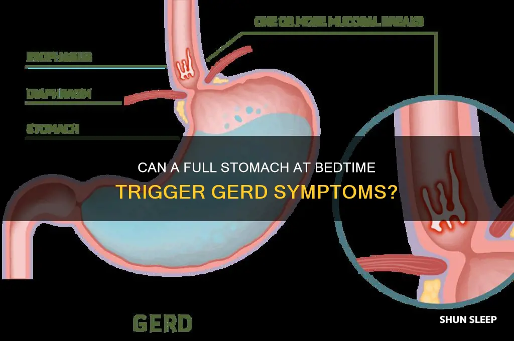 can yu get gerd from sleeping with full sotmach once