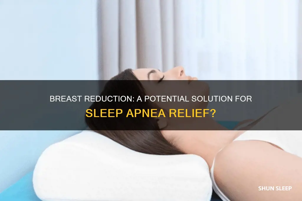 could a breast reduction help ease sleep apnea