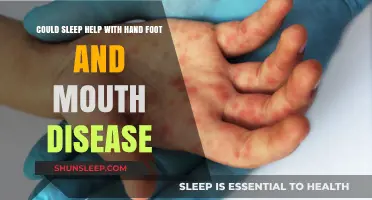Sleep's Role in Recovering from Hand, Foot, and Mouth Disease