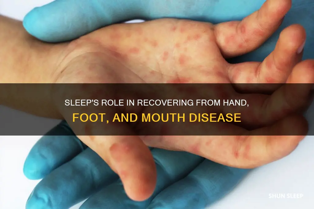 could sleep help with hand foot and mouth disease