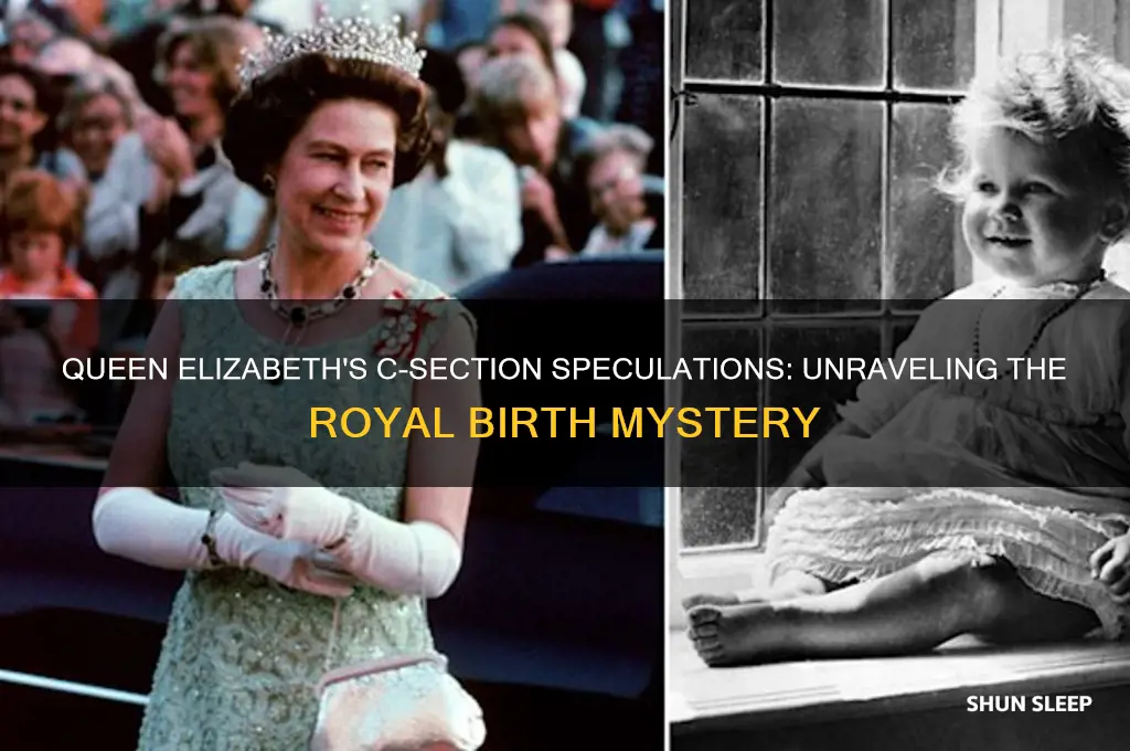 did queen elizabeth get put to sleep for c sections