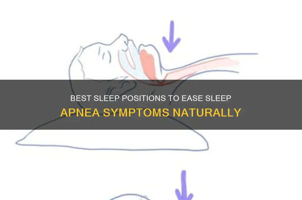 do any sleep positions help with skeep apnea