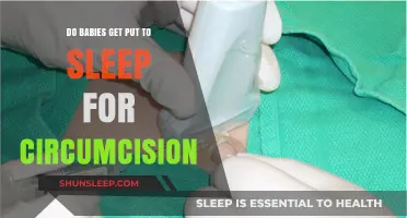 Do Babies Sleep During Circumcision? Understanding Anesthesia Use in Procedures