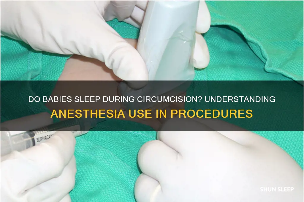 do babies get put to sleep for circumcision