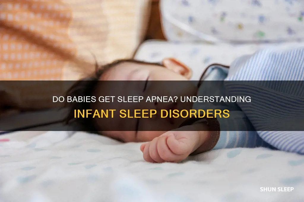do babies get sleep apnea