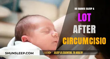 Post-Circumcision Sleep Patterns: Understanding Your Baby's Rest After the Procedure