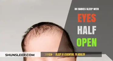 Why Do Some Babies Sleep with Their Eyes Half Open?