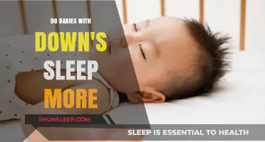 Do Babies with Down Syndrome Sleep More? Exploring Patterns and Needs