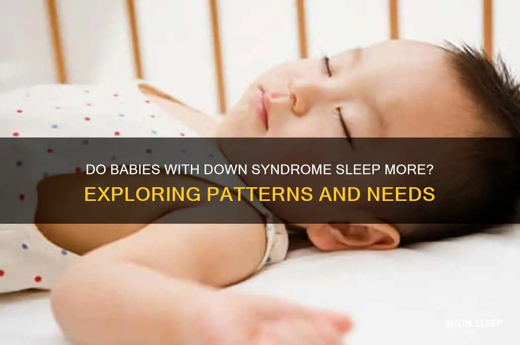 do babies with down