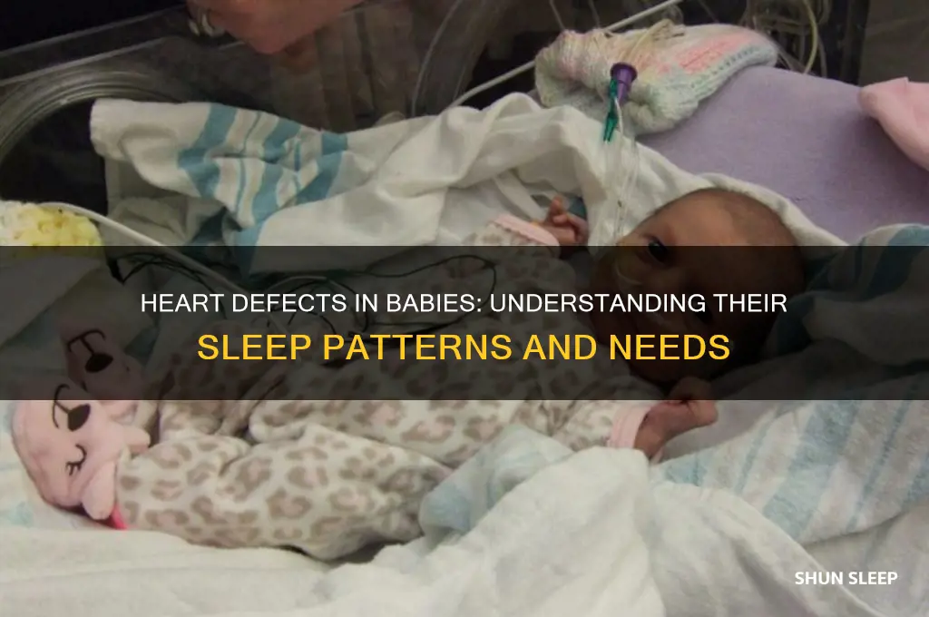 do babies with heart defects sleep more