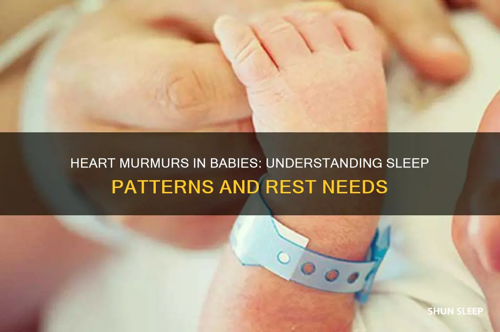 do babies with heart murmurs sleep more
