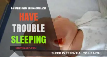 Laryngomalacia and Sleep: Understanding Challenges for Babies with Breathing Issues