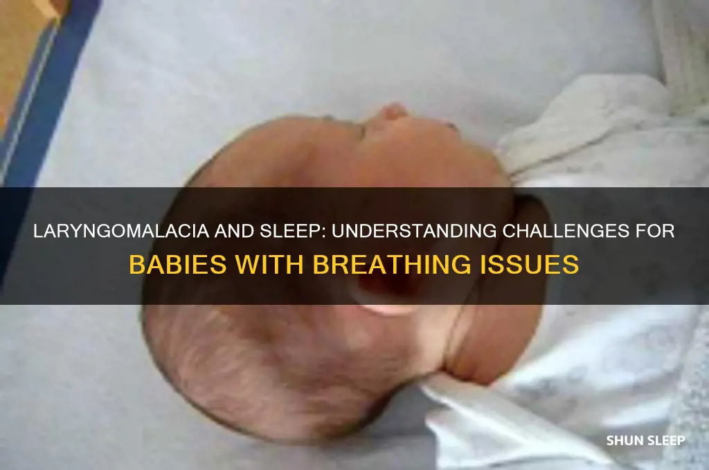do babies with laryngomalacia have trouble sleeping