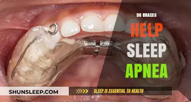 Braces for Sleep Apnea: Effective Treatment or Just a Myth?