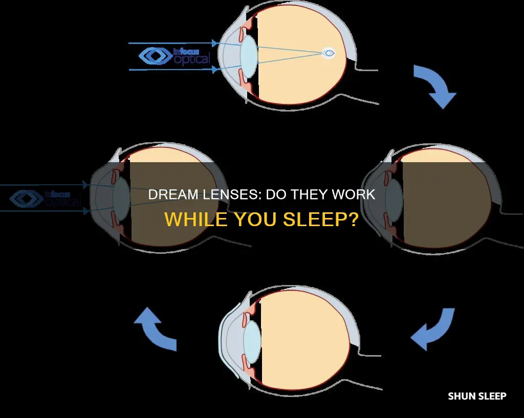 do dream lenses only work if youre sleeping