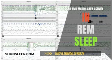 EMG Readings: Are We Active During REM Sleep?