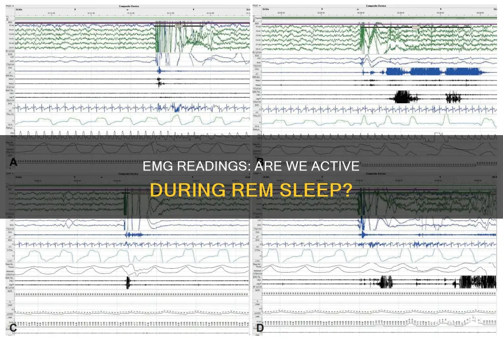 do emg reading show activity in rem sleep