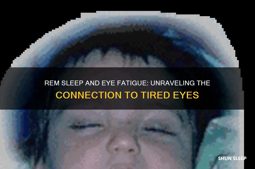 do eyes get tired from rem sleep