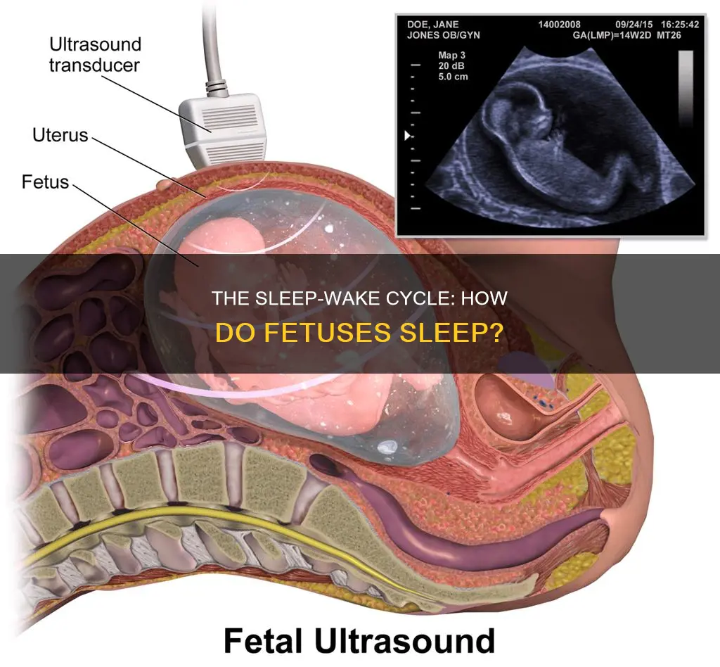 do fetuses have sleep wake cycle