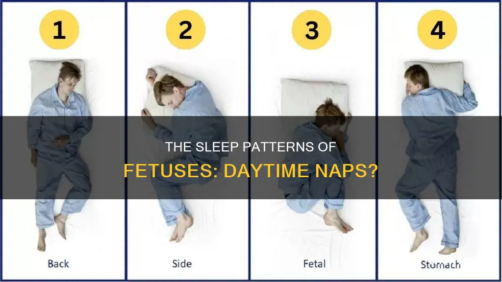 do fetuses sleep during the day