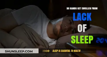 Lack of Sleep and Swollen Hands: Understanding the Connection
