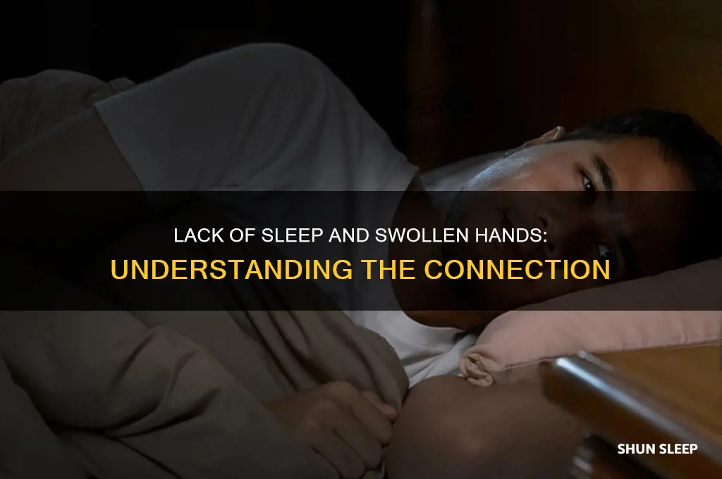 do hands get swollen from lack of sleep