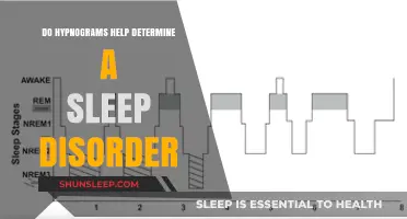 Hypnograms: Unlocking Sleep Disorder Diagnosis Through Sleep Stage Analysis