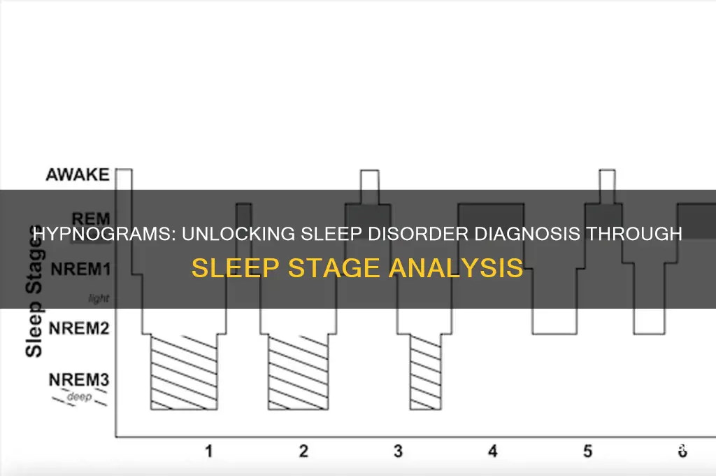 do hypnograms help determine a sleep disorder
