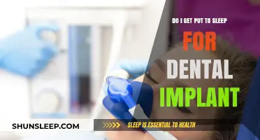 Do You Need Anesthesia for Dental Implants? What to Expect
