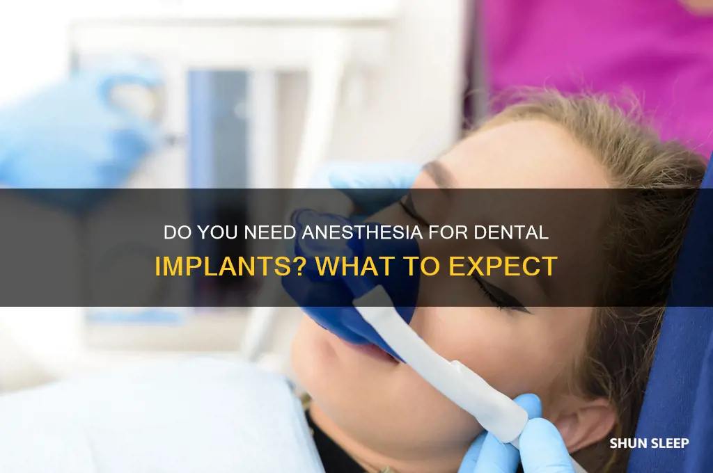 do i get put to sleep for dental implant