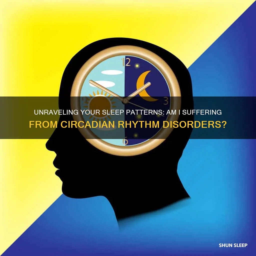 do i have circadian rhythm sleep-wake disorders