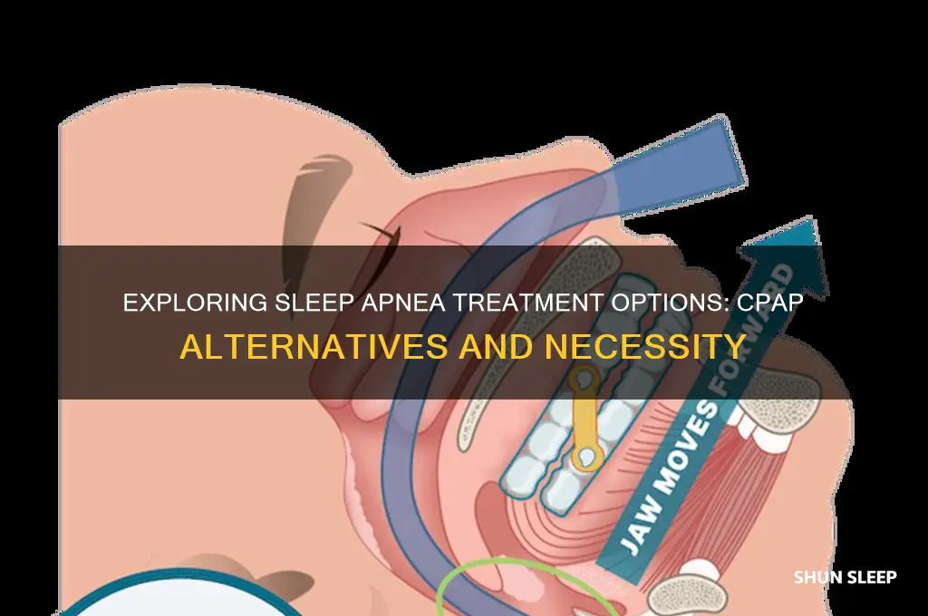 do i have to get a cpap for sleep apnea