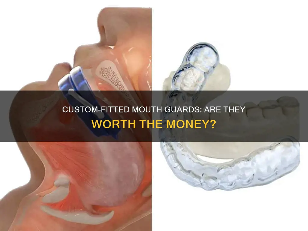 do i need a 600 mouth guard for sleep