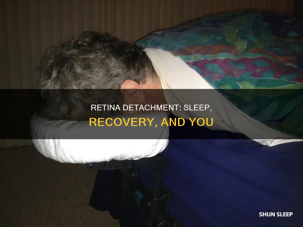 do i need to sleep for retina detached