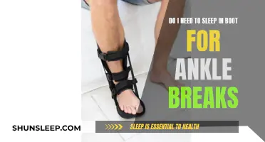 Should You Sleep in a Boot for Ankle Breaks?