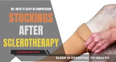 Compression Stockings: Necessary After Sclerotherapy for a Good Night's Sleep?